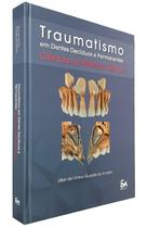 Livro Traumatismo em Dentes Decíduos e Permanentes, 1ª Ed - Santos Publicações
