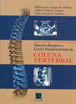 Livro - Tumores Benignos e Lesões Pseudotumorais da Coluna Vertebral Livro - Tumores Benignos e Lesões Pseudotumorais da Coluna Vertebral