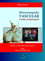 Livro - Ultrassonografia Vascular Livro - Ultrassonografia Vascular