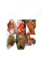 Livro Uma Abordagem Multidisciplinar Sobre Pé Diabét Batista - Andreoli Livro Uma Abordagem Multidisciplinar Sobre Pé Diabét Batista - Andreoli