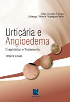 Livro - Urticária e Angiodema