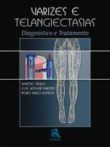Livro - Varizes e Telangiectasias Livro - Varizes e Telangiectasias