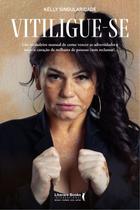 Livro - Vitiligue-se Livro - Vitiligue-se