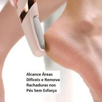 Lixador e Removedor de Calos e Rachaduras Para os Pés Elétrico Esfoliante Profissional Recarregável - ONLine