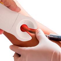 Localizador Acha Veia Aparelho Identificador Profissional de Coleta Sangue Ortho Pauher Localizador Acha Veia Aparelho Identificador Profissional de Coleta Sangue Ortho Pauher