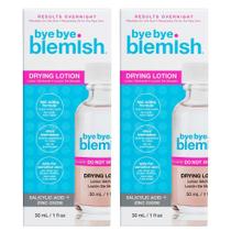 Loção para secar acne Bye Bye Blemish Reduce Pimples, pacote com 2 unidades Loção para secar acne Bye Bye Blemish Reduce Pimples, pacote com 2 unidades