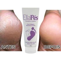 Loção Super Hidratante Afina Pés Joelhos E Cotovelos - Phytus