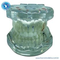 Macro Modelo Dentição Decídua em Acrílico Transparente