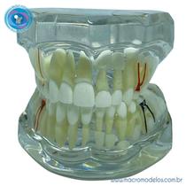 Macro Modelo Dentição Mista