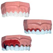 Macro Modelo Evolução da Doença Periodontal