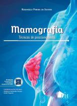 Mamografia Técnicas de Posicionamento