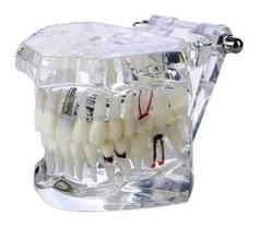 Manequim Modelo Molde Dentário Odonto Boca Transparente