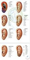 Mapa Auricoloterapia Regiões Auriculoacupuntura Acupuntura