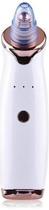 Máquina Sucção A Vácuo Remove Cravo Aparelho Acne Cleaning Máquina Sucção A Vácuo Remove Cravo Aparelho Acne Cleaning