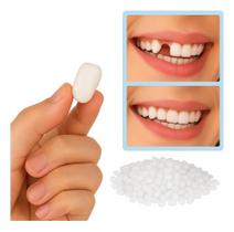 Massa Restauração Dente, Tampa Buraco Dental. Provisórios