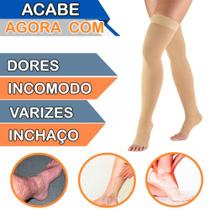 Meia 78 Bege Compressão Média Graduada Ponteira Aberta Para Circulação Inchaço Varizes Trombose Unissex