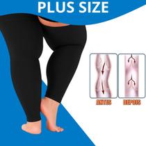 Meia Meia Coxa com Compressão OMG SUPER CONFORT Plus Size 2030mmHg Extra Macio e Ajuste Anatômico