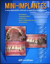 Mini-Implantes e Suas Aplicações Clínicas: a Experiência de Aarhus - - Doctor Livros