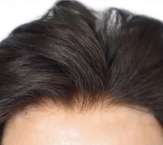 Mini prótese capilar frontal 100% cabelo humano franja topete - Especiallité Hair