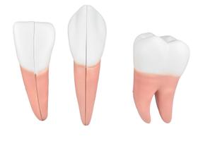 Modelo anatômico de dente em 6 partes (incisivo, canino e molar) sd5059h
