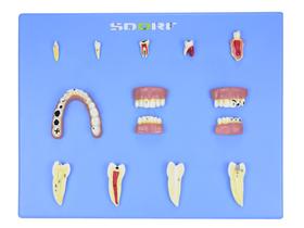 Modelo anatômico de patologias dentárias c/ 12 partes em placa sd5059l