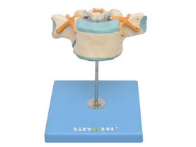 Modelo anatômico de vértebra torácica c/ cordão espinhal sd5014