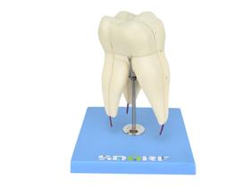 Modelo anatômico dente molar superior c/ raiz tripla em 3 partes, 8x o tamanho real aprox. - sd5059f