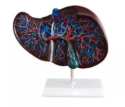 Modelo Anatômico Do Fígado Humano