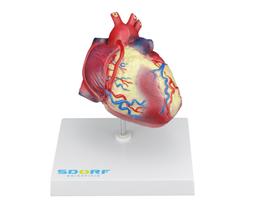 Modelo anatômico patológico do coração com hipertrofia em 2 partes sd5214