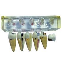 Modelo de Endodontia com 4 Elementos Modelo de Endodontia com 4 Elementos