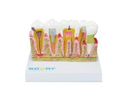 Modelo de Patologias Dentárias - SDORF