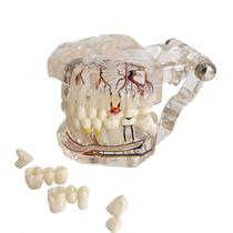 Modelo dentário YOUYA DENTAL Neural Repair Implant Disease