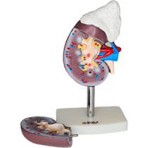 Modelo Do Rim Humano Com Glândula Adrenal