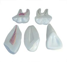 Modelo Expansivo Dente Humano - 3 tipos