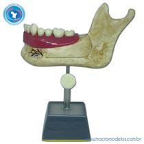 Modelo Hemi Mandibula de Jovem - Macro Modelos Modelo Hemi Mandibula de Jovem - Macro Modelos