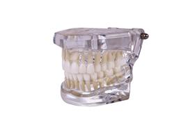 Modelo odontológico de ortodontia Classe I oclusão normal transparente