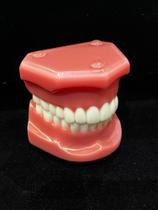 Modelo odontológico de ortodontia em Classe I Oclusão Normal Rosa