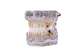 Modelo odontológico de pediatria 5 anos dentição decídua Modelo odontológico de pediatria 5 anos dentição decídua