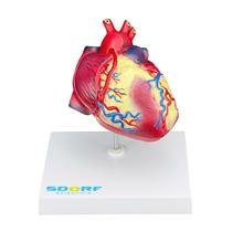 Modelo patológico do coração com hipertrofia em 2 partes