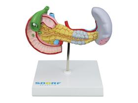 Modelo Patológico do Pâncreas, Baço, Duodeno e Vesícula Biliar - SDORF