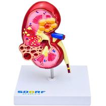 Modelo patológico do rim