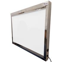 Negatoscópio 2 Corpos em Aço Inox LED 60x45cm - Portal Hospitalar Negatoscópio 2 Corpos em Aço Inox LED 60x45cm - Portal Hospitalar