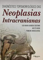 Neoplasias intracranianas - Di Livros Editora Ltda