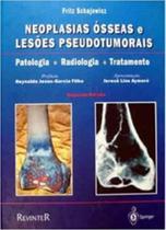 Neoplasias Ósseas e Lesões Pseudotumorais - 02Ed/2000 - REVINTER Neoplasias Ósseas e Lesões Pseudotumorais - 02Ed/2000 - REVINTER