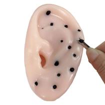Novelty Popping Pimples Blackhead Toy em forma de orelhas com pinça