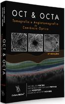 Oct & Octa Tomografia E Angiotomografia De Coerência Óptica - Cultura Médica Oct & Octa Tomografia E Angiotomografia De Coerência Óptica - Cultura Médica