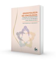 Odontologia na oncologia: atenção interdisciplinar à saúde bucal do paciente com câncer de boca - Santos Publicações