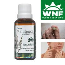 Oleo de Melaleuca para Acne Pele Oleosa Unha Caspa WNF 30ml