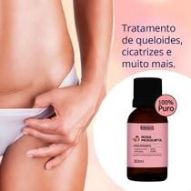 Óleo De Rosa Mosqueta 100% Puro 30Ml - Farmax (Kit 3 Unid)