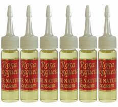 Óleo De Rosa Mosqueta Original Chileno Importado 15ml 6 Uni Óleo De Rosa Mosqueta Original Chileno Importado 15ml 6 Uni